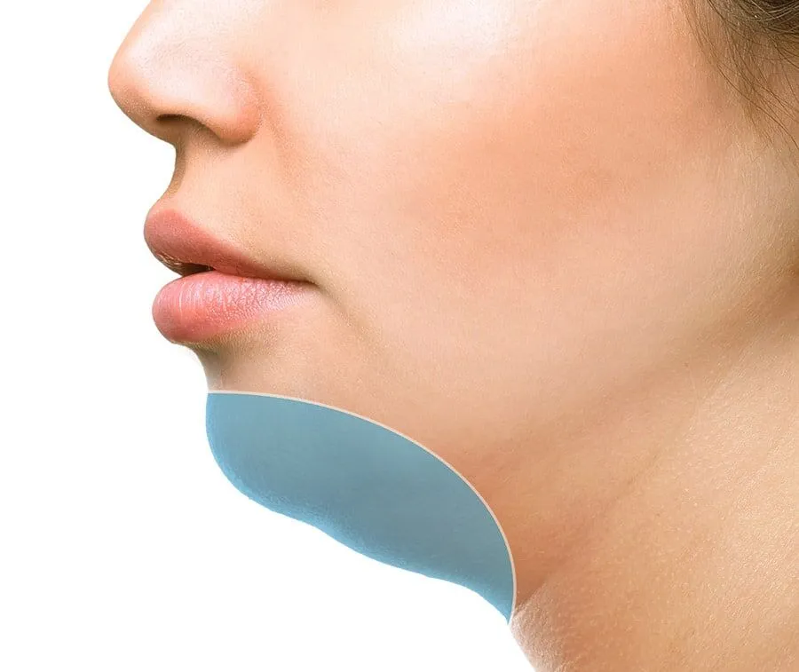 chin fat